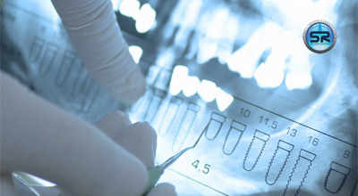 Diagnosi della disodontiasi